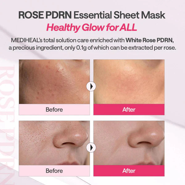 MEDIHEAL Rose PDRN Essential Mask (10 PCs)