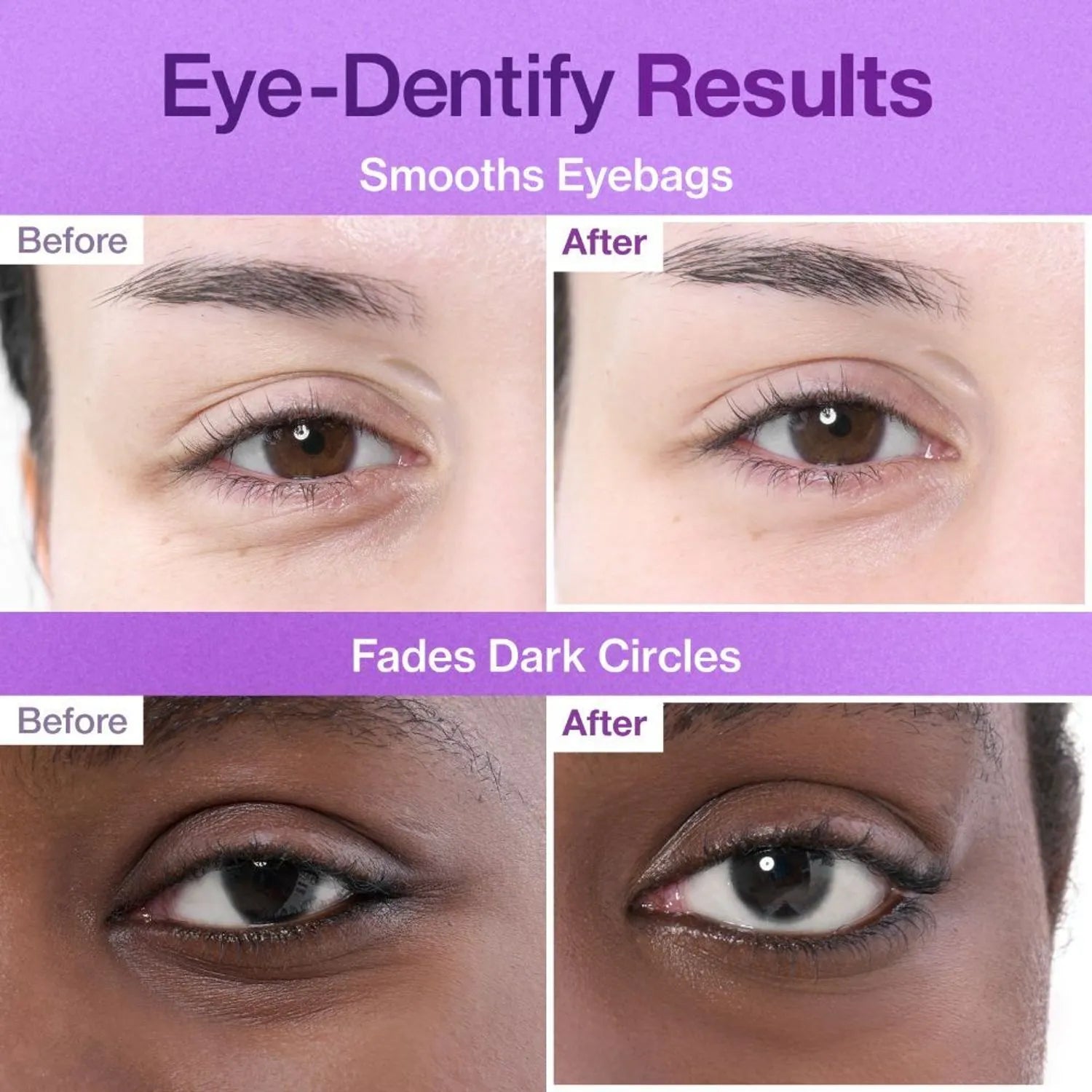 Numbuzin No. 9 NAD Collagen Overnight Selfie Patch